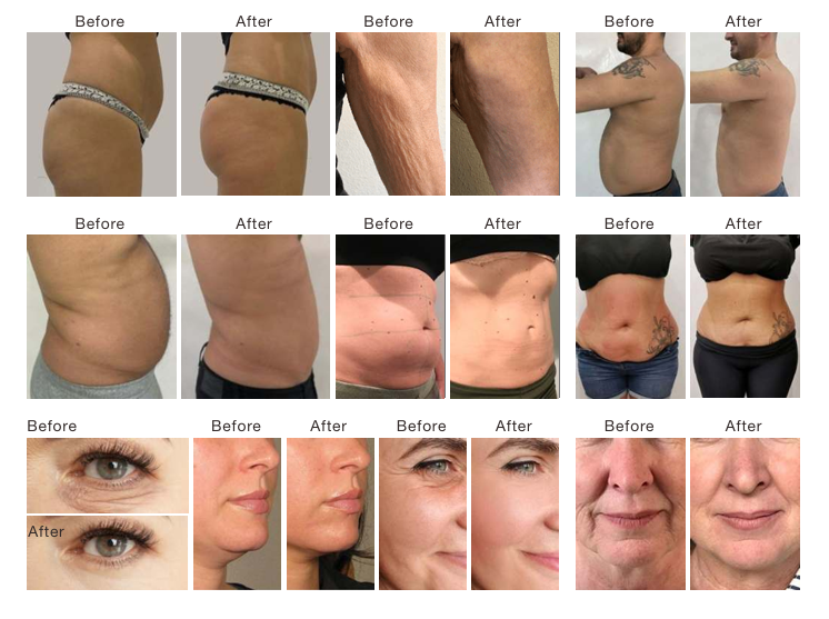 V-Shape Platinum