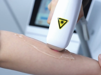 Innovative multi-wave  HAIR REMOVAL PLATFORM