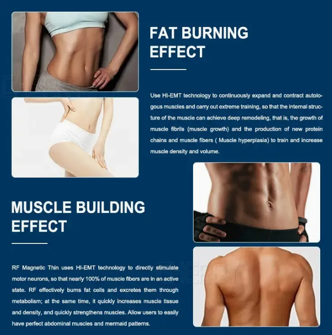 High-Intensity Electromagnetic Muscle Trainer (HI-EMT) Technology