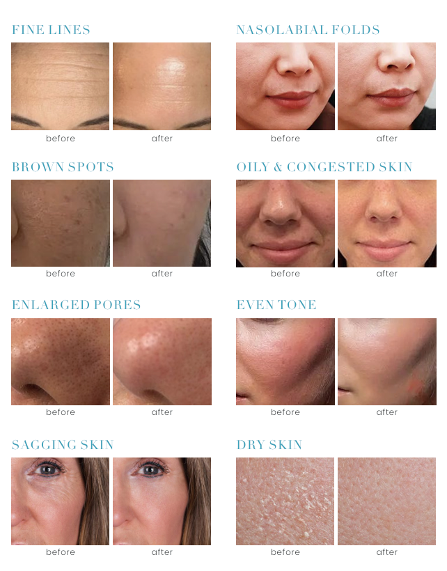 Meet all skin  care needs!
