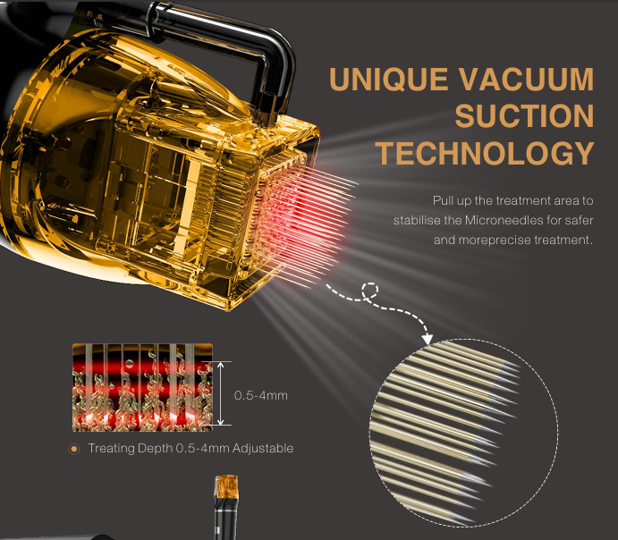 RFM Star™ Professional 3-in-1 Microneedling RF System with Vacuum Suction Technology